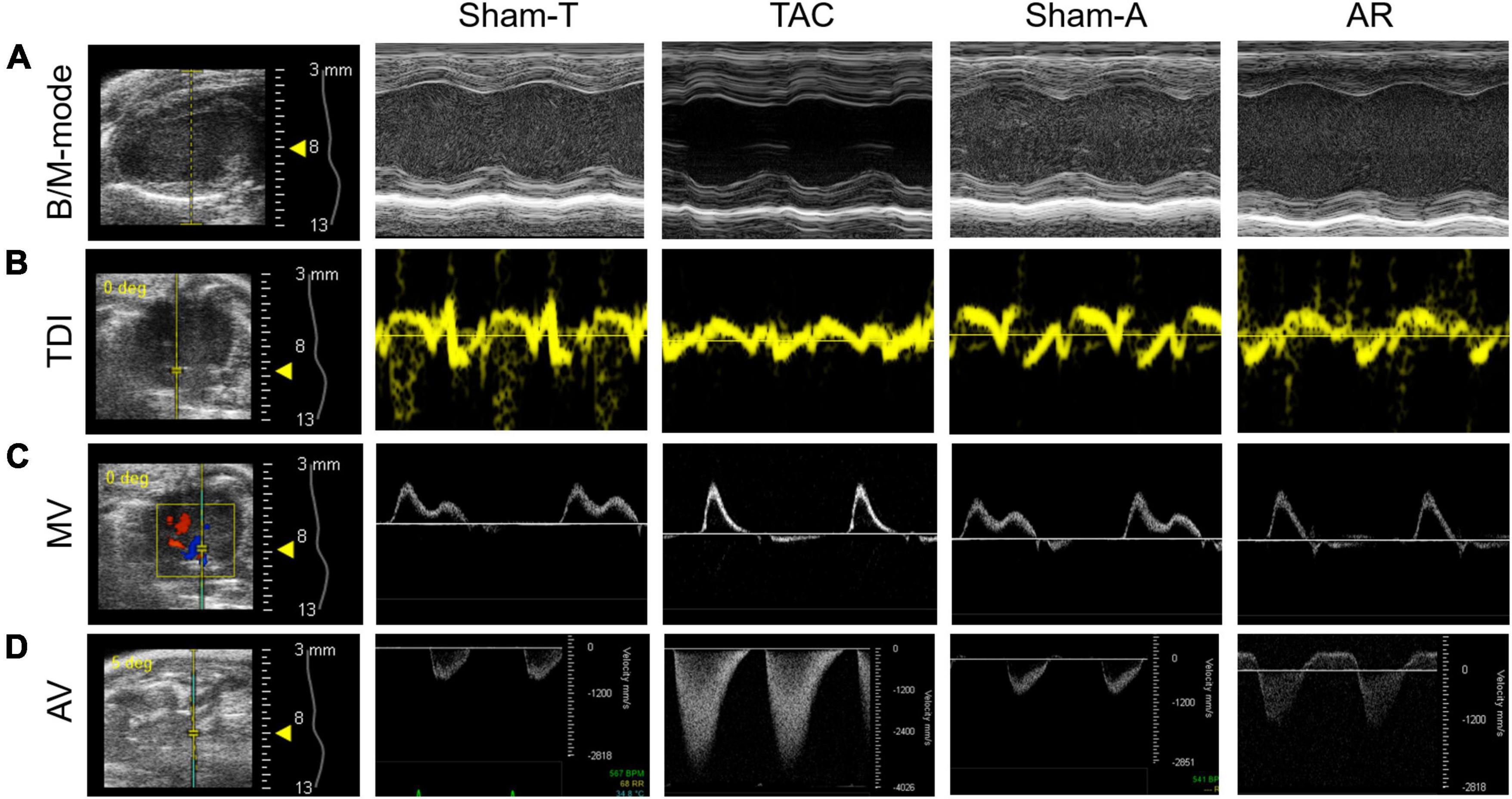 Identification of early cardiac dysfunction and heterogeneity after pressure and volume overload in mice by high-frequency echocardiographic strain imaging